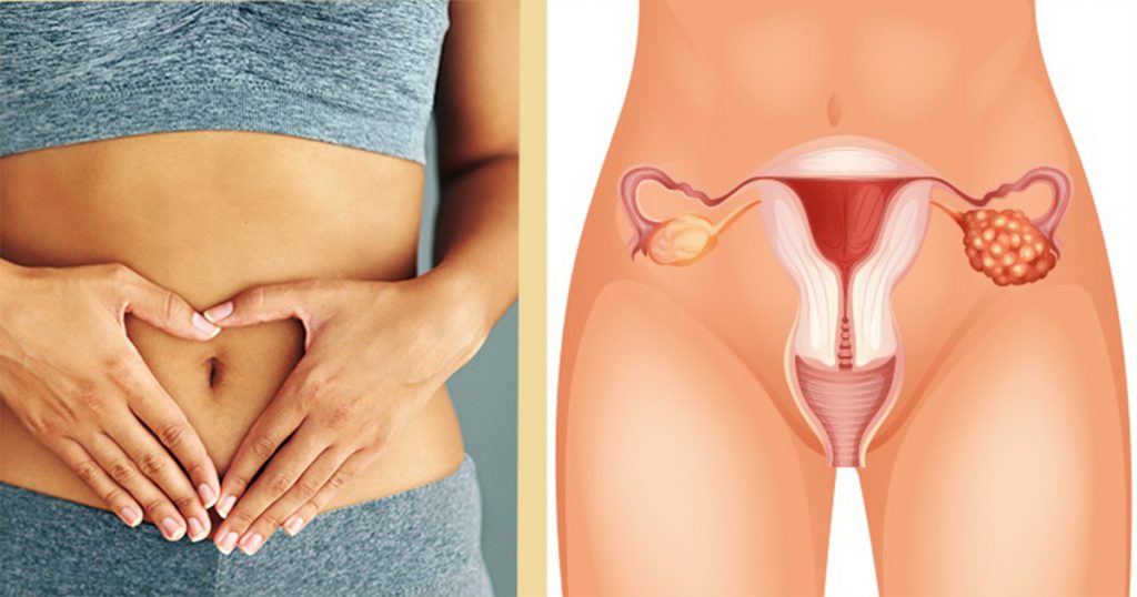 symptoms of ovarian cancer