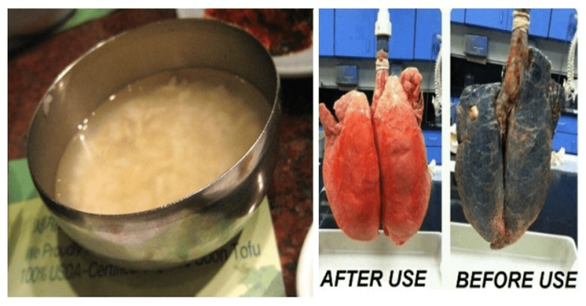 This Recipe Will Help Clear Your Lungs If You Have Been Smoking For