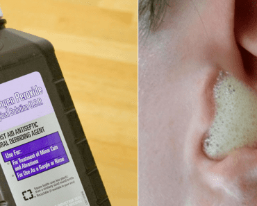Important Benefits Of Keeping Hydrogen Peroxide Around Your House