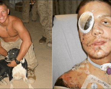 He Jumped On Grenade To Save Fellow Marines, Somehow Lived To Tell The Tale…