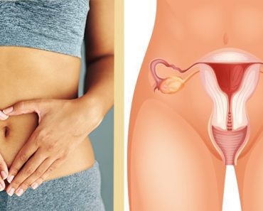 Every Woman Should Know These 4 Early Symptoms Of Ovarian Cancer