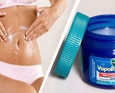 Treat Stretch Marks, Eczema And More: 15 Surprising Uses For Vicks VapoRub