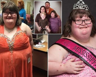 Obese Teenager Is So Hungry She Rifles Through Bins
