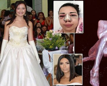 Jennifer Pamplona Surgery: Spends $500k To Look Like Kim K