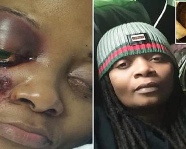 Louisiana Army Veteran Is Tasered In Her Eye By Police And Loses Sight