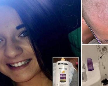 Woman Is Forced To Shave Her Head Because Of Tampered Conditioner