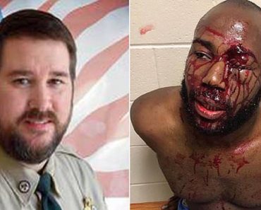 Photo Reveals Brutal Injuries Suffered By A Black Man By White Deputies